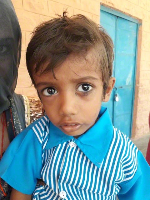 World Vision India